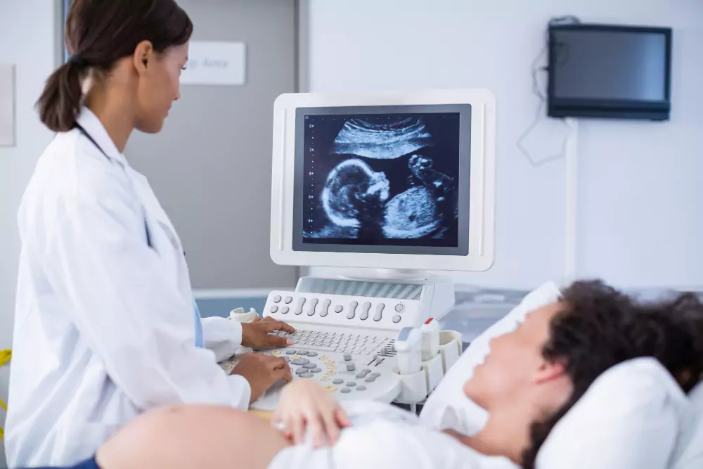 Color Doppler Study
